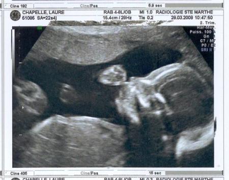 &eacute;chogaphie du 2&egrave;me trimestre.